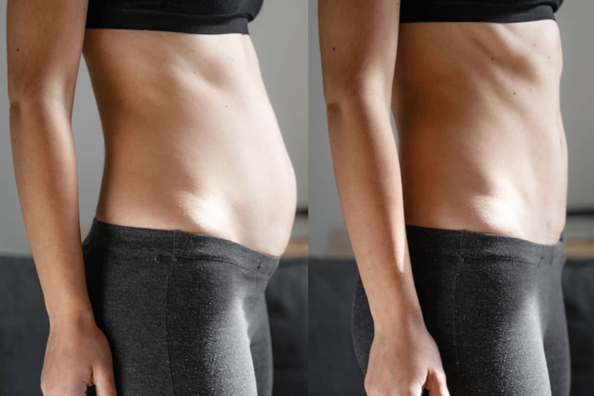 Post-Pregnancy: What Happens to Your Abdominal Muscles After Birth Rutland