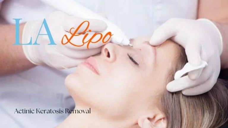 Woman receiving Actinic Keratosis Removal Treatment Rutland