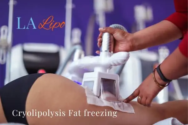 women getting fat freezing Rutland