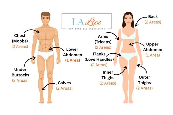 LA LIPO Cryolipolysis Areas Rutland