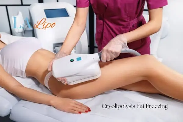 Woman receiving coolsculpting Rutland treatment on her thighs