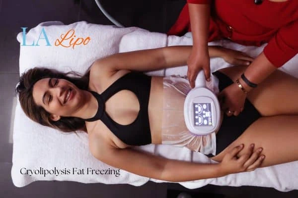 woman getting cryolipolysis Rutland