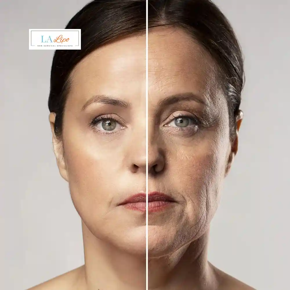 How Can You Tell If Non-Surgical Skin Tightening Is Right for You Rutland?