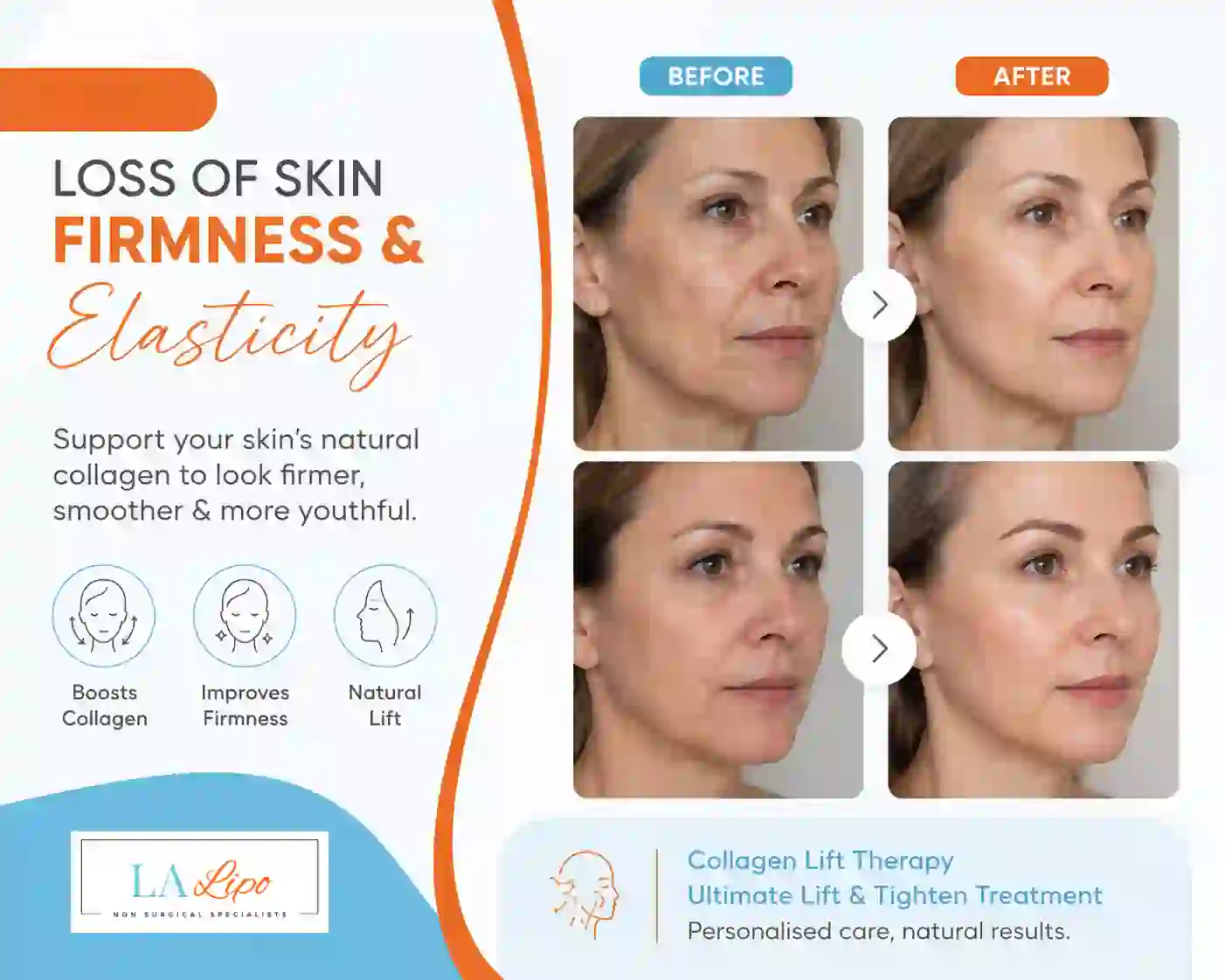 Sign #7: Loss of Skin Firmness and Elasticity Rutland